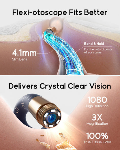 New Bebird EarSight Plus I35R Visual Ear Cleaner