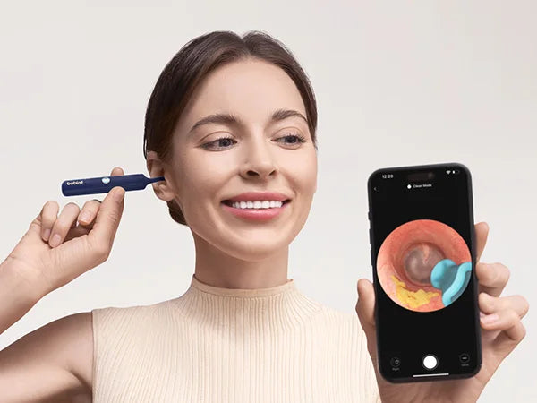 New Bebird EarSight Plus I35R Visual Ear Cleaner