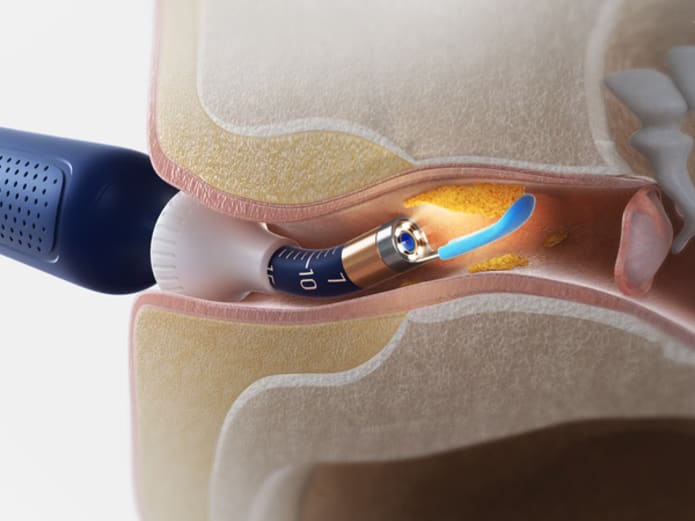 New Bebird EarSight Plus I35R Visual Ear Cleaner