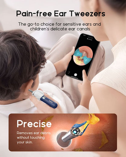 New Bebird EarSight Plus I35R Visual Ear Cleaner